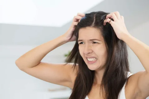 Home Remedies for Itchy Scalp